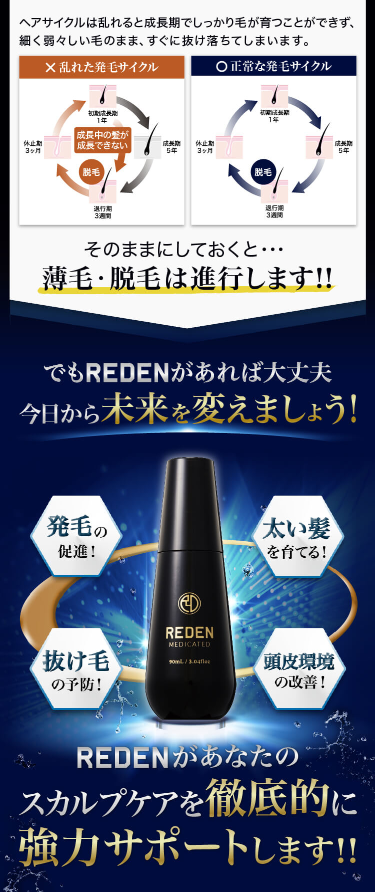 忙しい毎日は薄毛の原因で溢れています